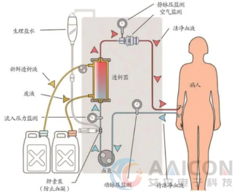 医疗视觉工控一体机助力血液透析医疗信息系统解决方案